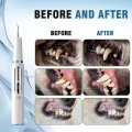 Pet Ultrasonic Teeth Cleaner Dog Electric Teeth Cleaning Tool Home Dentistry Tartar Remover (Černý)